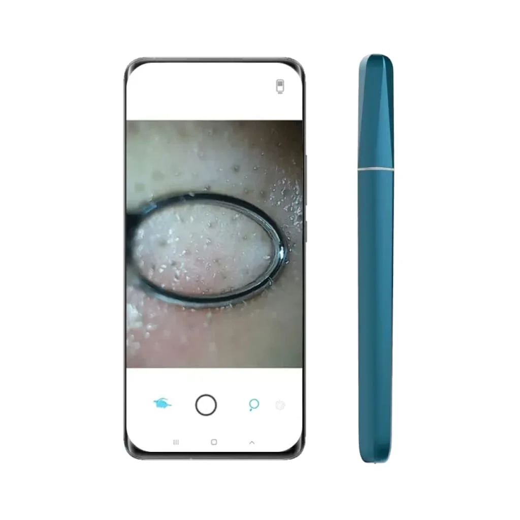 Wisdom Smart Pore Cleaner with Camera
